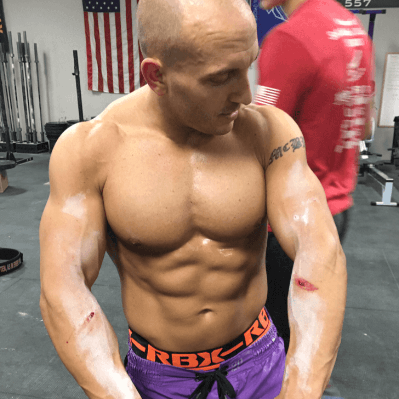 Ring Rash Guards™ - Patent Pending